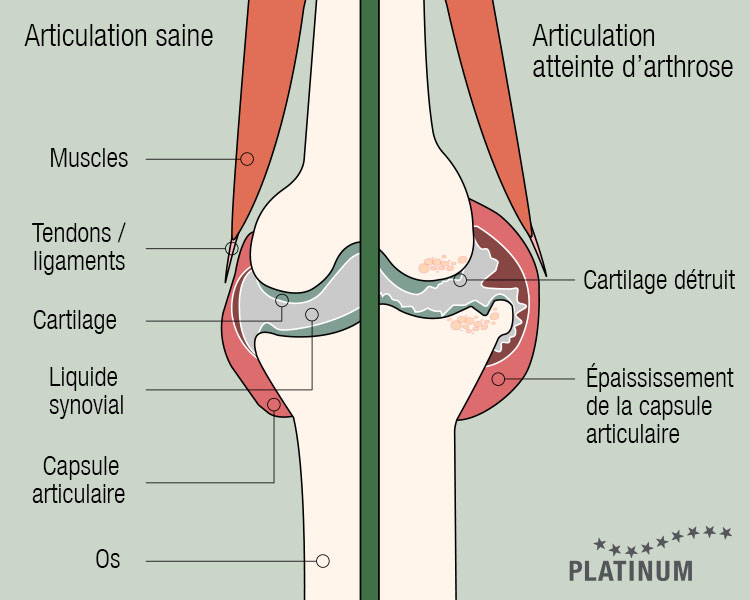 Comparaison entre une articulation canine saine et une articulation atteinte d'arthrose